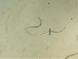 Invertebrate #11