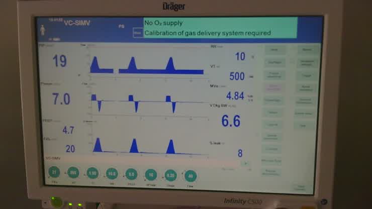 VC-SIMV vs. VC MMV