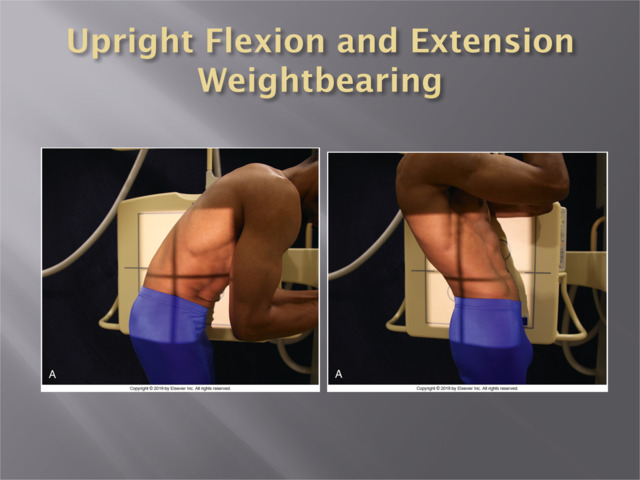 Unit 10: Flexion/Extension, and Bending Views Thursday, January 4, 2024 ...