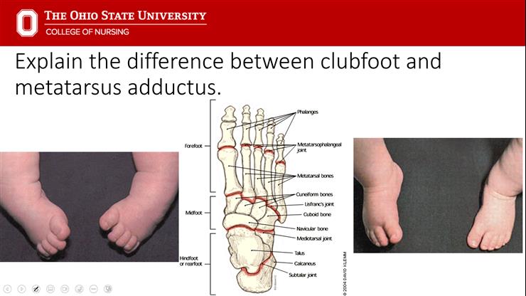 Ortho 2 Musculoskeletal Trauma