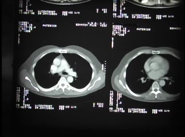 FIELDS Thorax Radiology Video