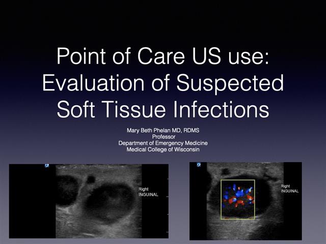 May 14, 2020 Conference: POCUS in Evaluation of Soft Tissue Infections