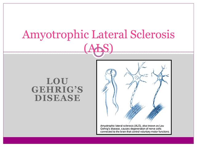 ALS (Amyotrophic Lateral sclerosis)