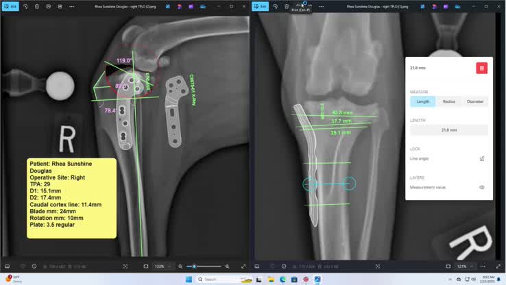 Rhea Sunshine Douglas: R TPLO
